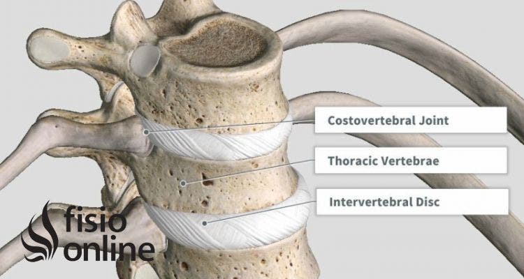 síndrome costovertebral doloroso