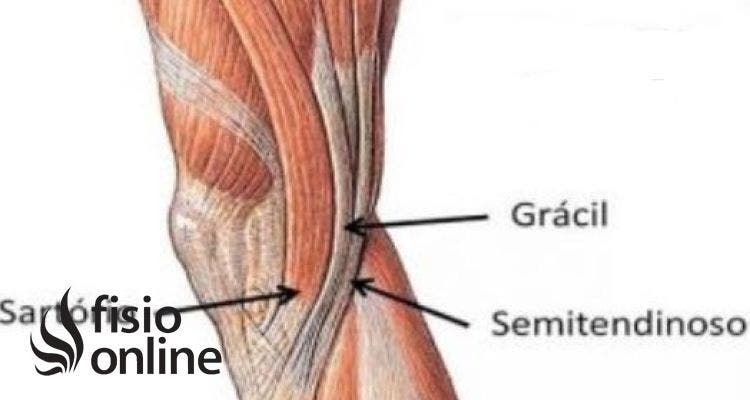 Tendinitis de la pata de ganso