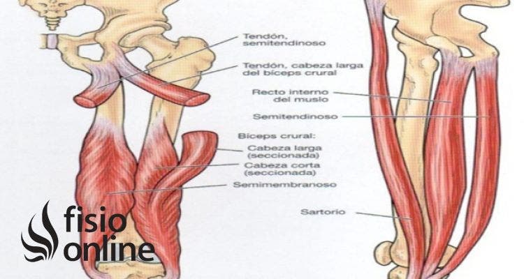 Tendón del Semimembranoso