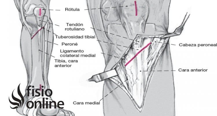 Tuberosidad de la tibia