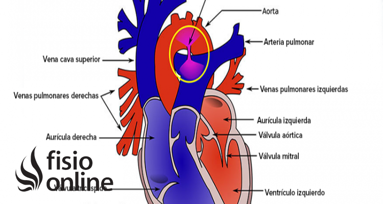 vena cava inferior