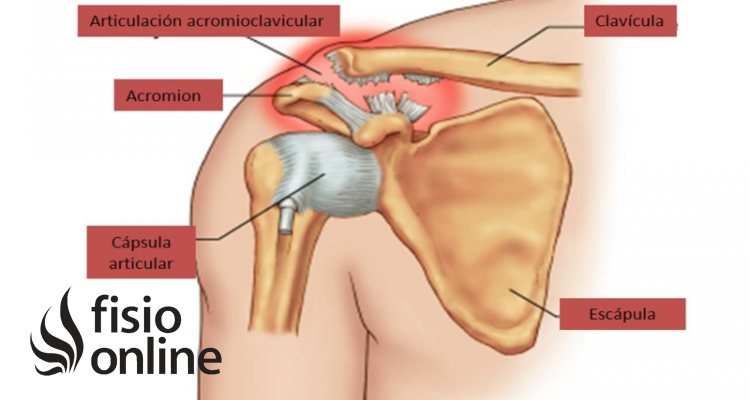 articulación acromioclavicular