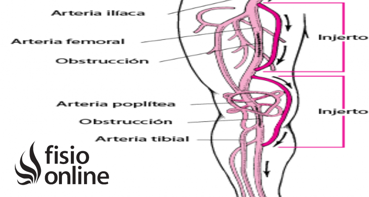 arteria poplítea