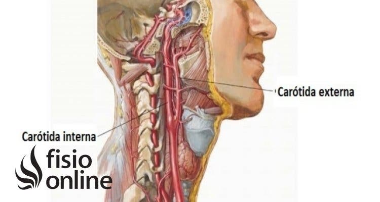 carótida interna