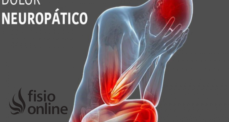 Inaccesible cada lino Dolor neuropático | Qué es, características, tipos, en qué patologías  aparece, por qué y cómo se produce