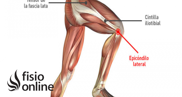 Tendón de la Fascia Lata