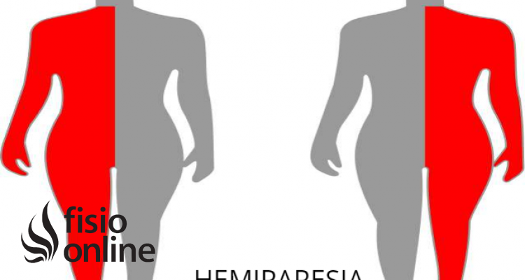 hemiparesia