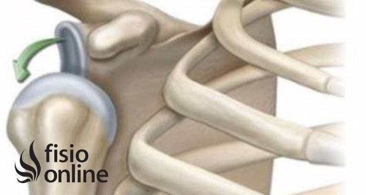 inestabilidad de hombro
