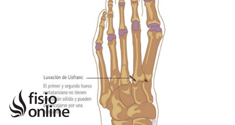 Articulación de Lisfranc