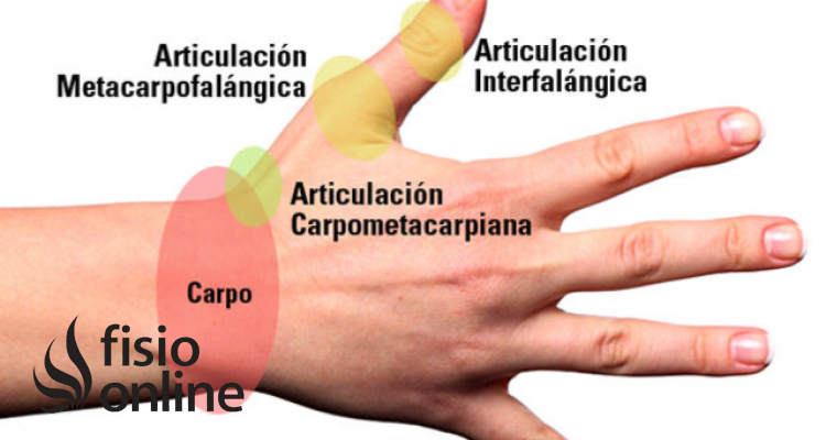 Articulación Metacarpofalángica