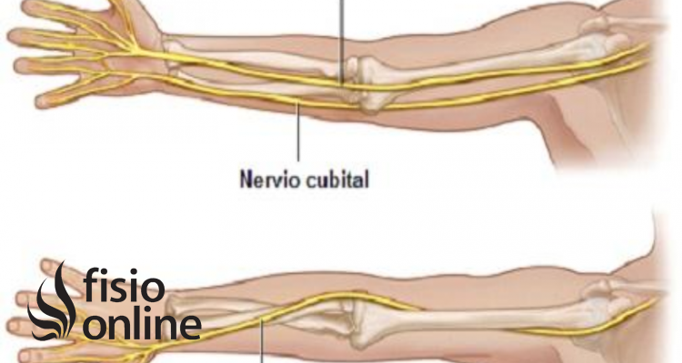 nervio mediano 