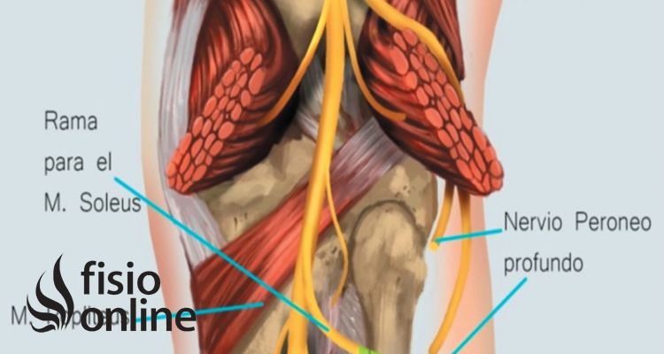 nervio tibial posterior