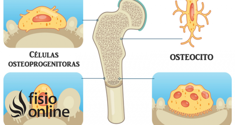 osteoclastos