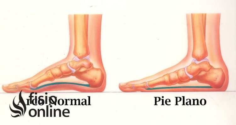 Pie Plano