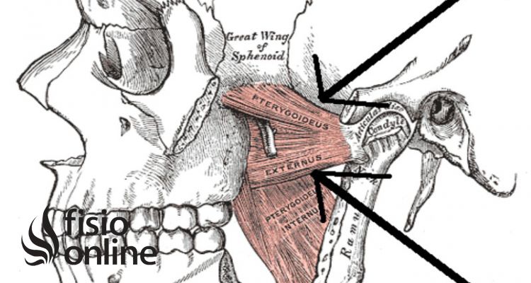 músculo pterigoideo lateral