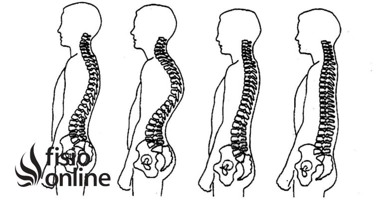 Rectificación dorsal