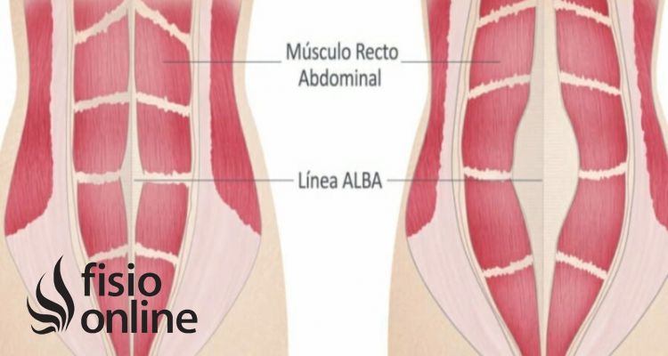 Músculo recto abdominal