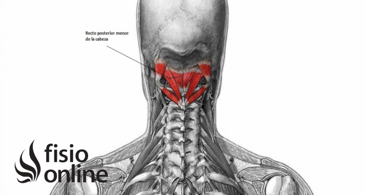 músculo recto posterior menor de la cabeza 