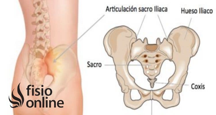 articulación sacroilíaca