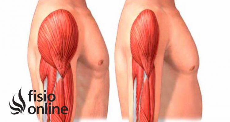 sarcopenia