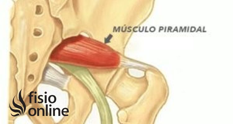 Sindrome del piramidal