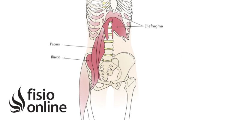 Tendinitis del psoas 