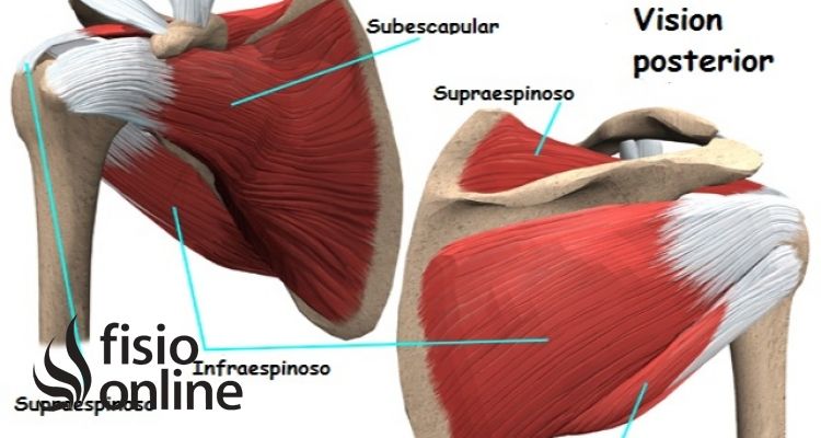 Tendón del Subescapular