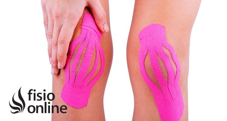 Kinesiotape ¿Cual es la mejor aplicación para lesiones musculares?