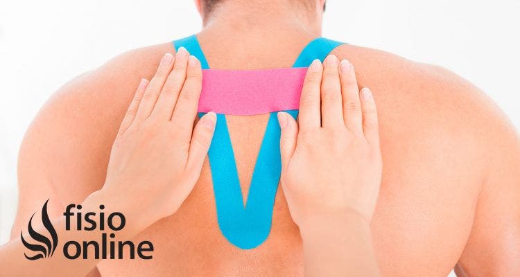 Corrección postural con Kinesiotape o Vendaje neuromuscular. ¿De verdad puede ayudarnos?