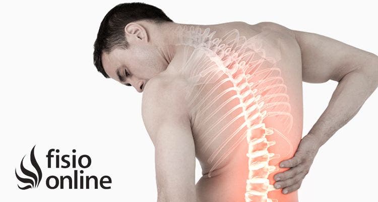 ¿En qué consiste el tratamiento de fisioterapia del acuñamiento vertebral?