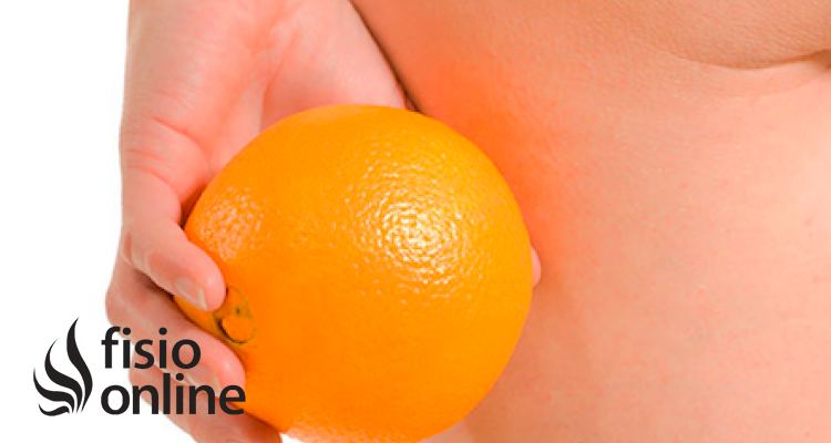 celulitis tratamiento y causas