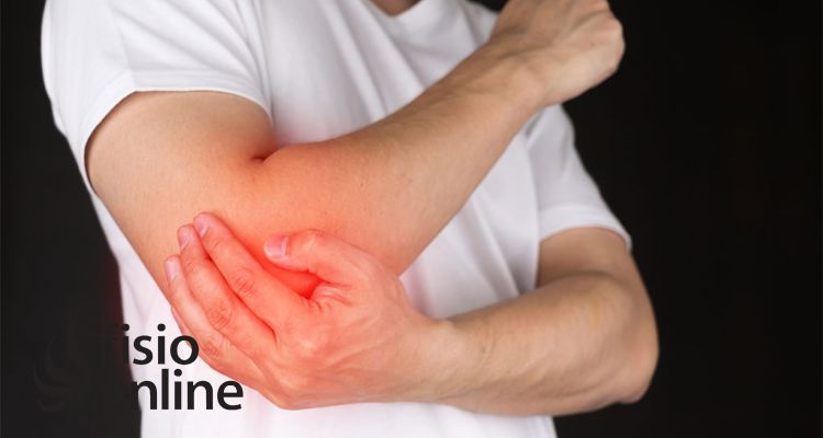 Epicondilitis lateral: por qué tu dolor de codo no se resuelve con fisioterapia convencional, reposo ni fármacos