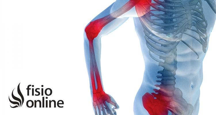 Las principales alteraciones relacionadas con las articulaciones.