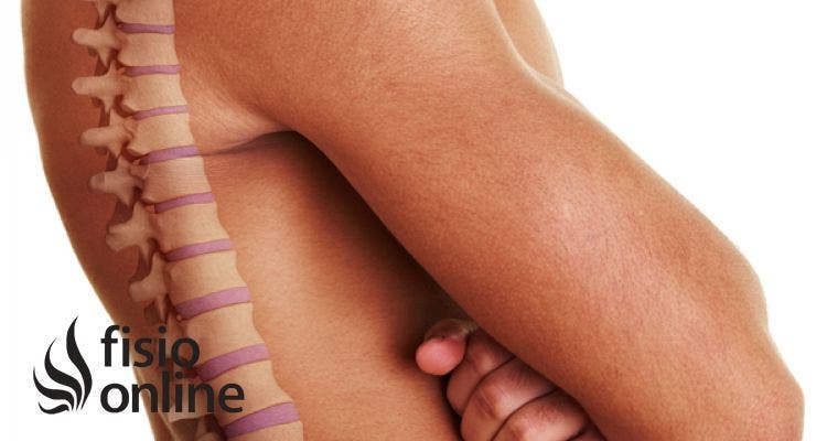 La lordosis o curvatura lumbar, ¿Qué es? Consejos y ejercicios para recuperarla