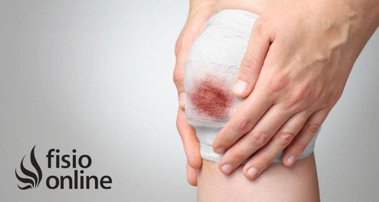 Cómo actuar ante una hemorragia