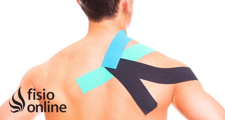 kinesiotaping o vendas de colores ¿Qué es y como funciona?