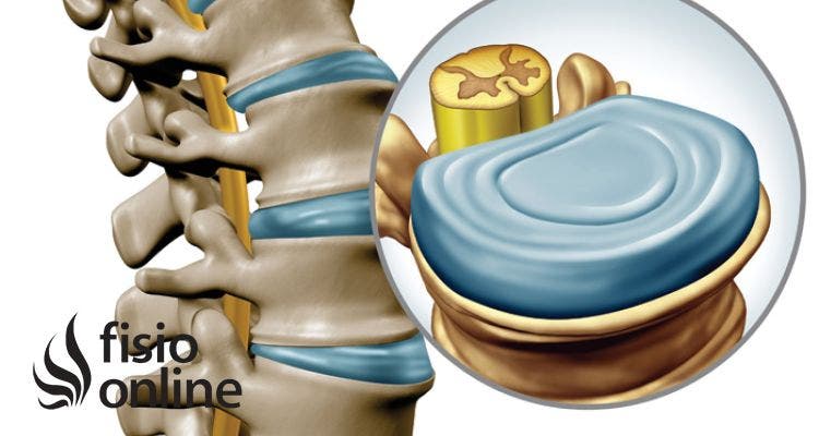 5 Curiosidades que no sabías sobre el disco intervertebral, su estructura y su funcionamiento