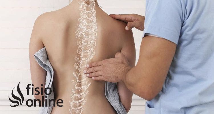 ¿Tienes una escoliosis funcional? Cómo la disfunción visceral puede modificar tu postura