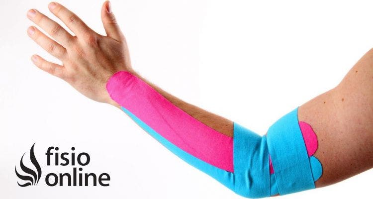 Kinesiotaping Cuando Si Y Cuando No Indicaciones Y Contraindicaciones De Su Aplicación Fisioonline
