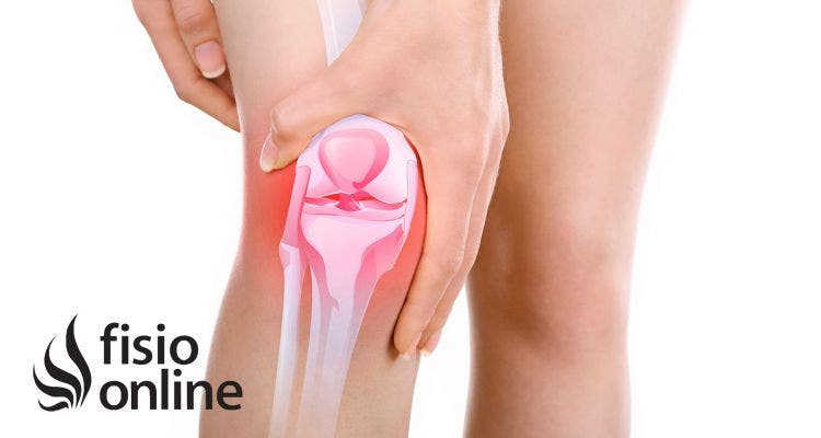 ¿Qué es una bursitis de rodilla? Causas, diagnóstico y tratamiento en fisioterapia y medicina