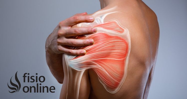 Diagnóstico de la tendinitis del manguito rotador o de hombro. Cómo saber si la padeces.