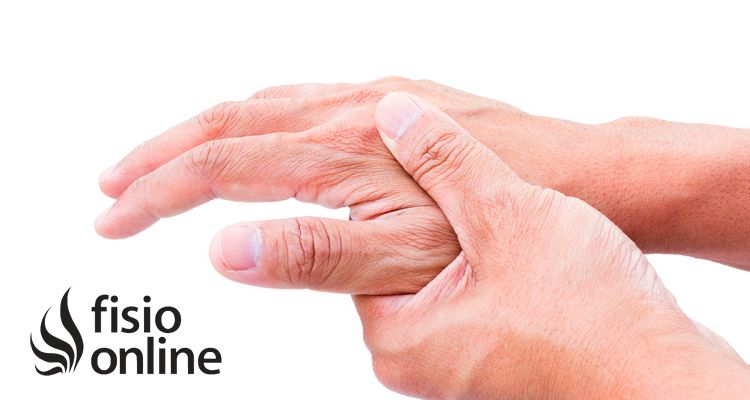 Artritis reumatoide ¿Qué es? ¿Cómo tratarla?