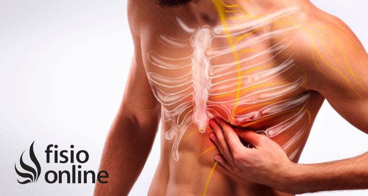 Dolor en el esternón y las costillas: ¿puede ser el síndrome de Tietze?