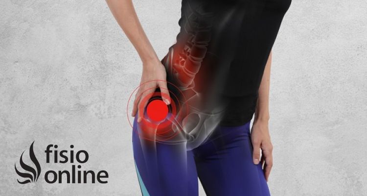 ¿Cómo se diferencia el pinzamiento femoroacetabular de la tendinitis del psoas?