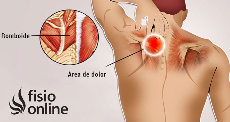 Reeducación postural global en el dolor interescapular