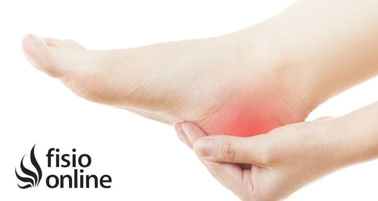 Espolón calcáneo: cómo aliviar el dolor del talón desde casa y prevenir su aparición desde un enfoque funcional y corporal completo