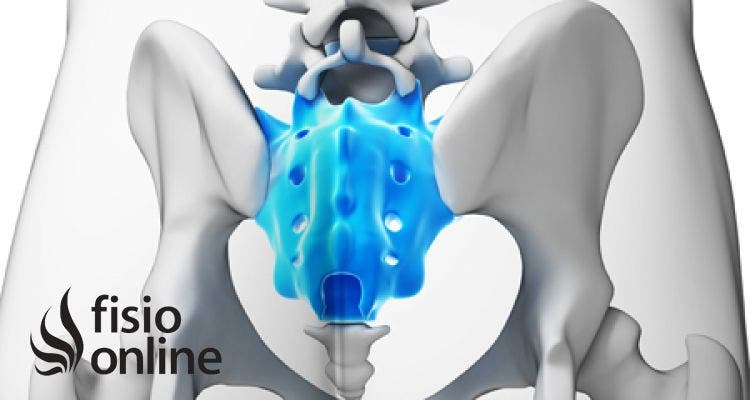 Tratamiento para el dolor sacro iliaco o sacro-ileítis