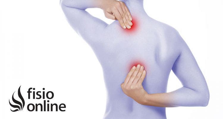 Nudos la espalda, musculares. tratamientos | FisioOnline