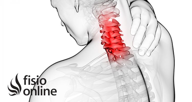 Artrosis cervical o Cervicoartrosis. Causas, síntomas y tratamiento