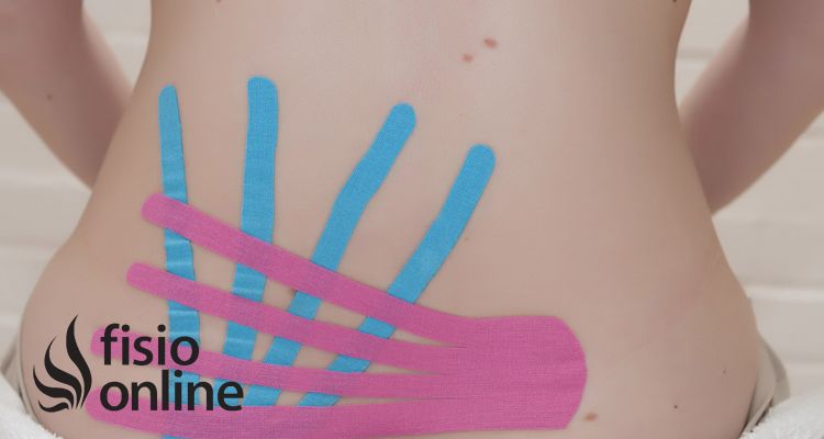 ¿Esparadrapo de colores? No, Kinesio-Taping